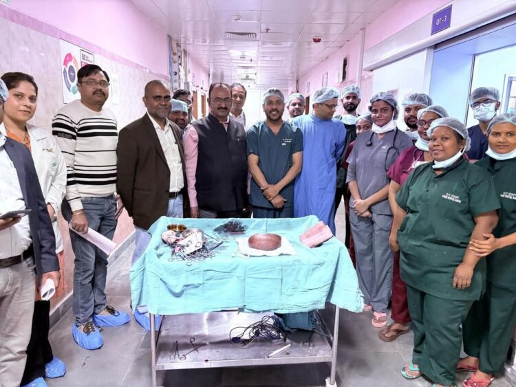 17 साल पुराना विशाल ट्यूमर ऑपरेशन से बाहर !